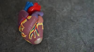 Heart Attack