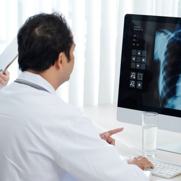 A doctor in a white coat, recognized as the best pulmonologist in Metro Manila, examines a chest X-ray image displayed on a computer monitor. Next to the doctor, a nurse in a blue uniform holds a clipboard and stands. A glass of water and keyboard are on the desk. Vertical blinds cover the window in the background.